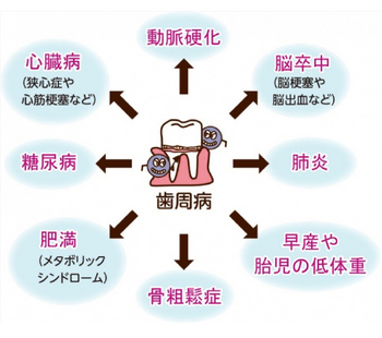 periodontal_03.jpg